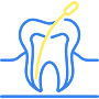 Root Canal