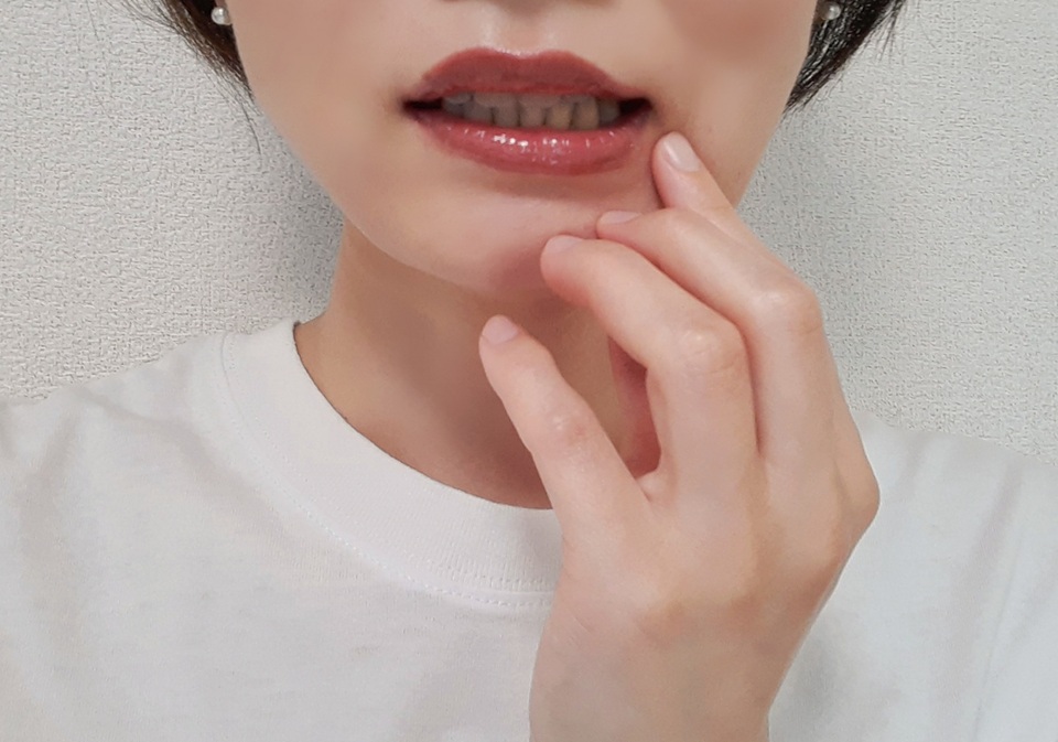 歯周病とは——気づかないうちに進行するサイレントディジーズ